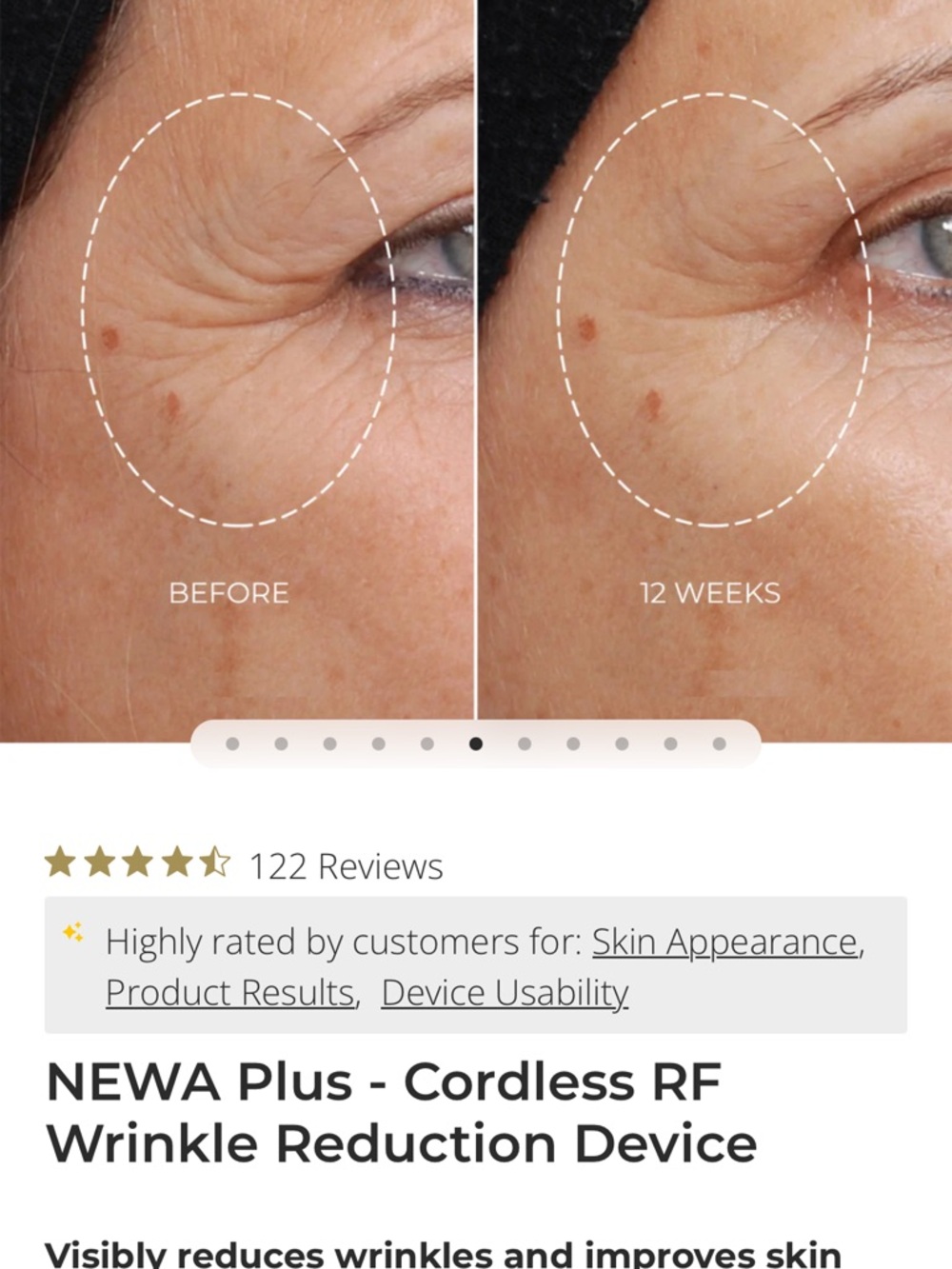 NEWA Plus - Cordless RF
Wrinkle Reduction Device - Picture 5 of 6
